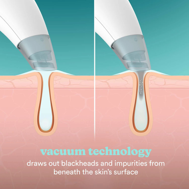 Mynd Homedics Refresh Hydra andlitshreinsun